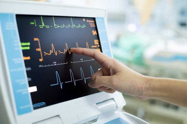 ECG/Electrocardiogram